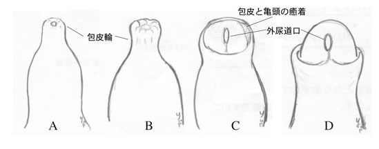 炎症 亀頭